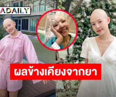 ส่งใจให้! “ออน พัชรวรรณ” รองนางสาวไทย ป่วยมะเร็งต่อมน้ำเหลือง ล่าสุดหน้าบวมแต่ขอยิ้มสู้