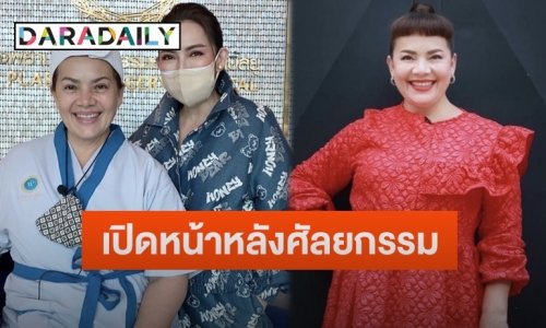 ปังมาก!! เปิดภาพ “แหม่ม สุริวิภา” หลังขึ้นเขียงทำศัลยกรรม