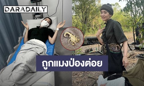 ตกใจ! “เบลล่า” ถูกแมงป่องต่อยกลางกองถ่ายละคร ลั่นโปรดเรียกชั้นว่าหญิงแกร่ง