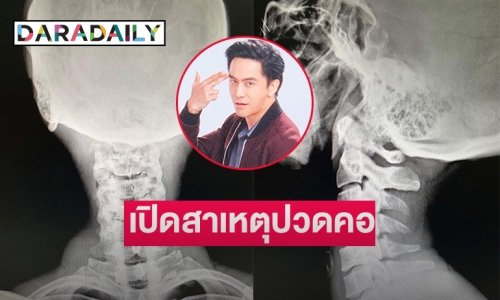 แฟนๆ ส่งกำลังใจ “จอร์จ ฐปนัท” ต้องพักยาวเพราะเหตุนี้
