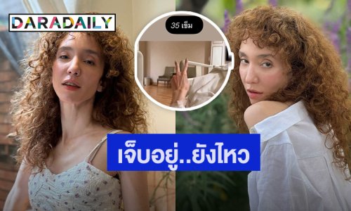 เจ็บแต่ไหว! “คลาวเดีย” ประสบอุบัติเหตุ วูบล้มหัวฟาด! เย็บ 35 เข็ม