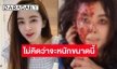 เกิดอะไรขึ้น? “เป้ย ปานวาด” หน้าเละ ทำโซเชียลแตกตื่น