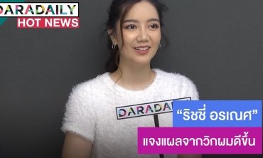 ​​​​​​​“ริชชี่” แจงแผลจากวิกผมดีขึ้น 70 เปอร์เซ็นต์