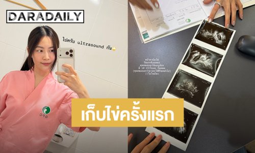 “ฟรัง นรีกุล” รีวิวฝากไข่ครั้งแรกในวัย 28 ปี