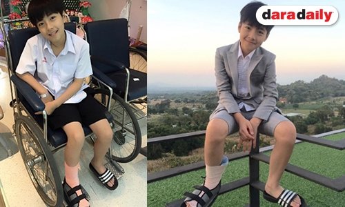 อัพเดทอาการ “น้องแม็ค” หลังตกบันไดขาพลิกเส้นเอ็นฉีก