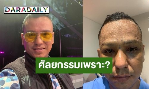 “ไท ธนาวุฒิ” ตัดสินใจทำศัลยกรรมหนังตาแล้ว เพราะเหตุผลนี้!