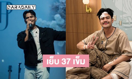 นักร้องดังเดินชนกระจกต้องเย็บ 37 เข็ม