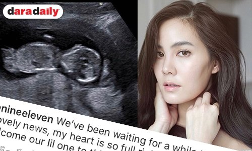 ว่าที่คุณแม่ “เจนี่” เบบี๋มาเคาะประตูแล้ว