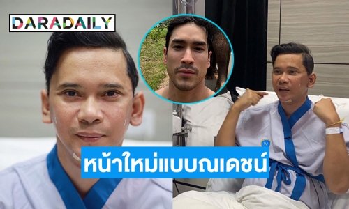 มีปัญหา “แมว จิระศักดิ์” ทำหน้าใหม่เป็น “ณเดชน์”