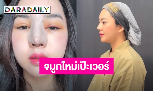 ส่องหน้าใหม่ “ยูทูปเบอร์ดัง” หลังควักเงินครึ่งล้านทำจมูก บอกเลยเป๊ะเวอร์