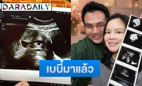 “สมปอง” ประกาศข่าวดี เตรียมเป็นคุณพ่อคนใหม่ เผยภาพอัลตราซาวด์สุดอบอุ่น-แท็กหา “แพรรี่”