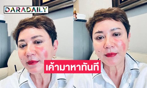 ดารารุ่นใหญ่เป็นผื่นแดงขึ้นแก้มน่ากลัวด้วยเหตุนี้