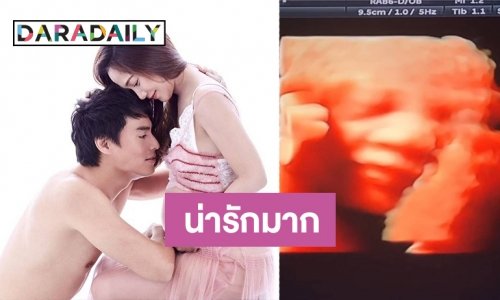 ส่องความน่ารัก “น้องมาร์โก้" ยิ้มเก่งตั้งแต่ในครรภ์