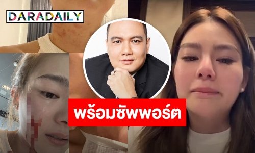 พร้อมซัพพอร์ต! “ไผ่ ลิกค์” ยื่นมือ แฉซ้ำ “ดิว” ถูกทำร้าย