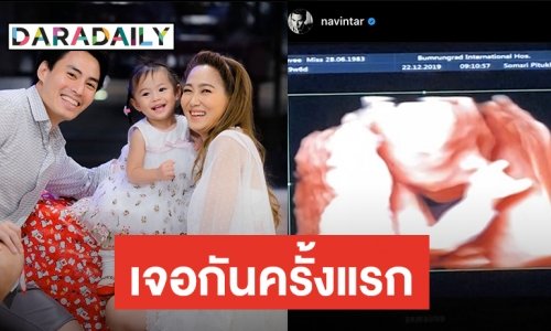 “นาวิน ตาร์” เปิดภาพเบบี๋คนที่ 2