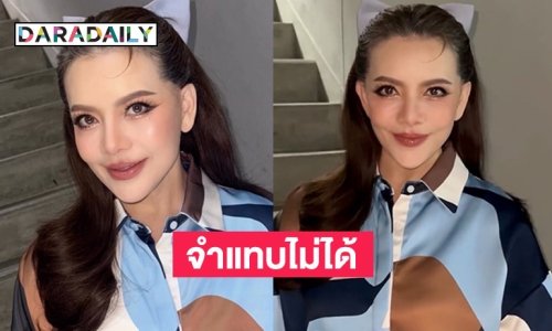 ส่องภาพล่าสุด “หนูแหม่ม สุริวิภา” หลังศัลยกรรมทำหน้าเด็ก