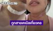 “นาฟ ฉัฐนันท์” เล่านาทีชีวิต ถูกสายเคเบิลเกี่ยวคอหวิดขาด 