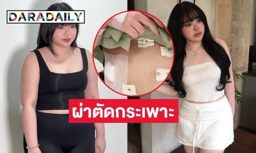 “เน็ตไอดอล”  รีวิวพลีชีพผ่าตัดกระเพาะ จาก 86 เหลือ 68 ในสามเดือน