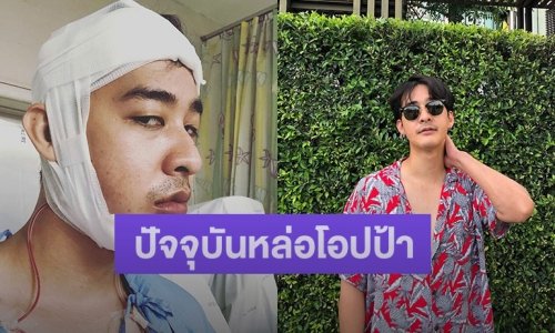 เปิดภาพปัจจุบัน “หม่อมเอ็ม” หลังผ่าตัดขากรรไกร บอกเลยหล่อโอปป้ามาก