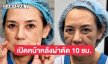เปิดภาพ “แหม่ม จินตหรา” หลังศัลยกรรมทำหน้าใหม่ ผ่านไป 10 ชม. เป๊ะเวอร์