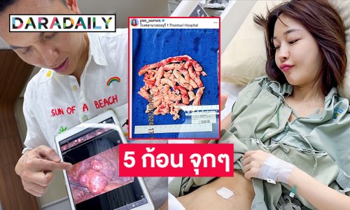 ไอดอลดังโชว์ภาพภาพนี้หลังผ่าตัดเนื้องอกในมดลูก
