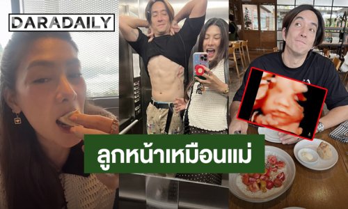 หน้าเหมือนแม่! “นุ่น รมิดา - หลุยส์ สก๊อต” ภาพอัลตร้าซาวด์ลูกสาว จมูกโด่ง แก้มยุ้ย