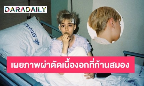 ครั้งแรก “นิ้ง ชัญญ่า” เผยภาพผ่าตัดเนื้องอกที่ก้านสมอง