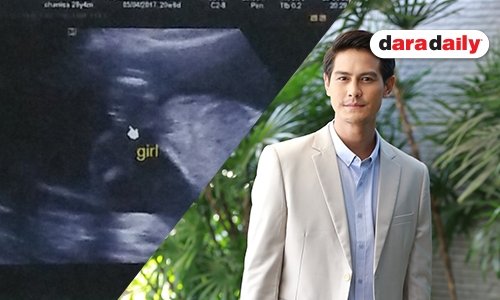 “น้ำ รพีภัทร” เตรียมไว้หนวดรอลูกสาว  เผยตั้งชื่อลูกแล้วว่า “น้องมาลีน”