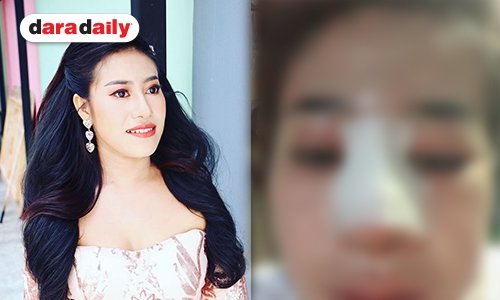 เตรียมสวย “หนูรัตน์” อัพดั้งใหม่เรียบร้อยแล้ว