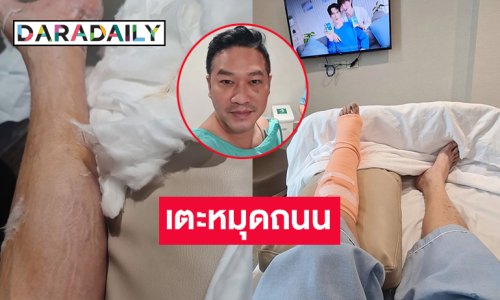 ดาวร้ายชื่อดังเพียงแค่ไปเตะหมุดถนนถึงกับต้องผ่าตัด