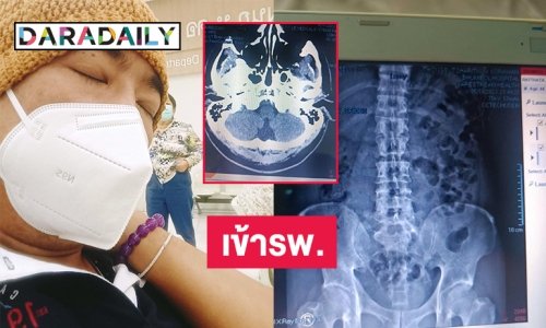 “อาทิตย์ ริว” เข้ารับการรักษาอาการด้านไขสันหลังและเชิงกรานจากอุบัติเหตุหลายปีก่อน