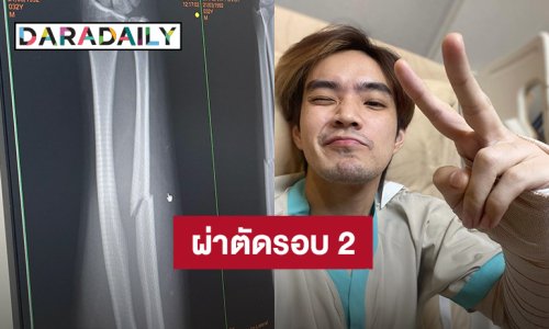 “บี๊บ Rooftop” ล้มทับแขนซ้าย แต่ลุกขึ้นมาเตะบอลต่อ สุดท้ายพีคแขนหัก