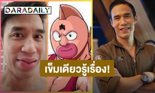 เข็มเดียวรู้เรื่อง! “ดอม เหตระกูล” ปากบวมหลังฉีดวัคซีนเข็มแรก