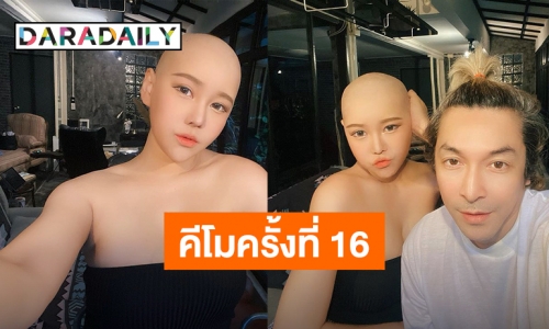 ยังยิ้มได้! “นุ๊กซี่” หวานใจ “ปู แบล็คเฮด” ให้คีโม 16 ครั้ง เผยอาการข้างเคียงมือดำ ตัวบวม หน้าบวม