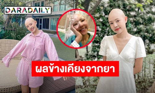 ส่งใจให้! “ออน พัชรวรรณ” รองนางสาวไทย ป่วยมะเร็งต่อมน้ำเหลือง ล่าสุดหน้าบวมแต่ขอยิ้มสู้