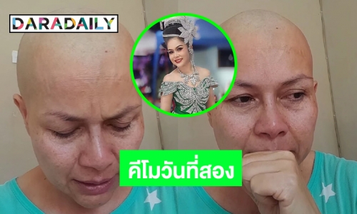 อย่างเจ็บมันมาแล้ว “เจี๊ยบ กนกพร” คีโมวันที่สอง