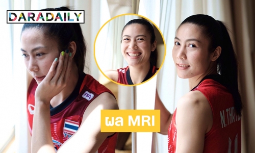 ผล MRI "ทัดดาว นึกแจ้ง” แพทย์วินิจฉัยแบบนี้ 