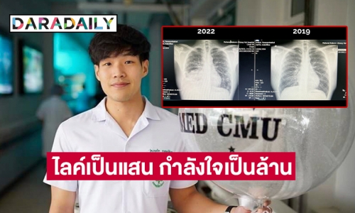 ไลค์เป็นแสน กำลังใจเป็นล้าน ให้หมอป่วยมะเร็งปอดระยะสุดท้าย