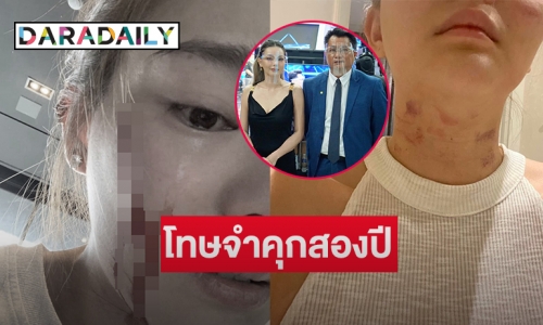 ทนาย “ดิว อริสรา” เผยโทษทำร้ายร่างกายจำคุกสองปีและยังไม่หมดอายุความ  