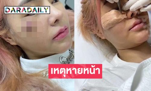 ไอดอลดังเผยเหตุหายหน้าไปจากยูทูปเพราะเหตุติดเชื้อตัวนี้