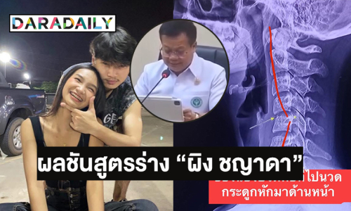 แพทย์สาธารณสุขจังหวัดอุดรธานีเผยผลชันสูตรร่าง “ผิง ชญาดา”