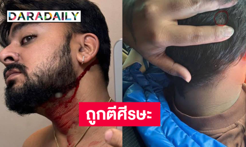 ด่วน! บังแจ็คถูกตีศีรษะ และถูกแย่งโทรศัพท์มือถือไอโฟน