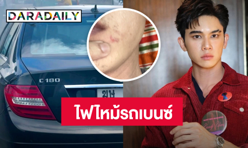 “ป๊อบ คำเกษม” ลุ้นระทึก! ไฟไหม้รถเบนซ์ เกือบเอาชีวิตไม่รอด