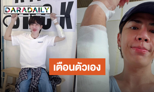 เตือนตัวเอง! “เอม วิทวัส” เล่าเกิดอุบัติเหตุรถล้ม อย่าประมาท
