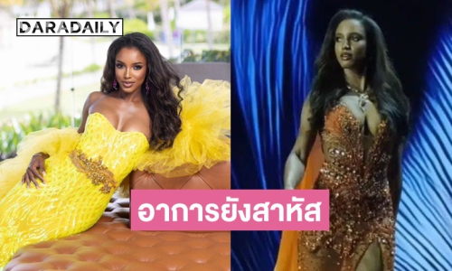 อัปเดตอาการ “มิสยูนิเวิร์สจาเมกา 2025” ตกเวทีรอบพรีลิม ยังสาหัส มีเลือดออกในสมอง
