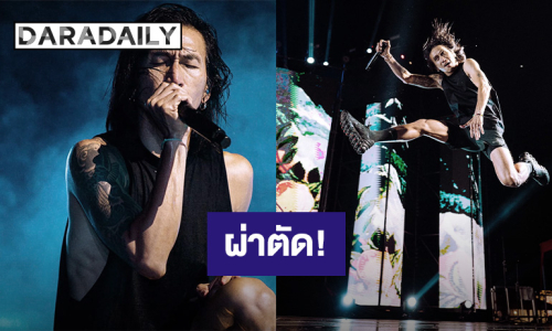 ส่งกำลังใจ! “ตูน บอดี้สแลม” เตรียมผ่าตัดกระดูกสันหลังคอ พักงาน 30 วัน