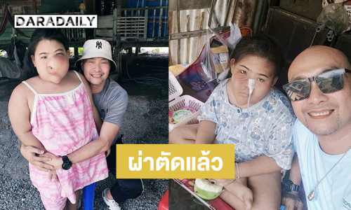 “อี๊ด เชิญยิ้ม”ช่วยน้องแววกระดูกผิดรูปผ่าตัดแล้วรอศัลยกรรมใบหน้า