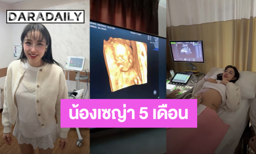 “แพท” อวดโฉม “น้องเซญ่า” วัย 5 เดือน อัลตร้าซาวด์ออกมาลูกสาวจมูกพุ่ง หน้าเหมือนพ่อ!