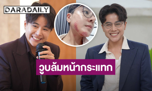 นักร้องเวทีดัง วูบล้มหน้าคว่ำคางแตก เหตุร่างกายขาดน้ำ