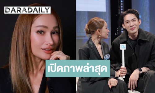 เปิดภาพล่าสุด “เปิ้ล” แชมป์ Surgery Wars EP3 หลังยกเครื่องใหม่ทั้งหน้า